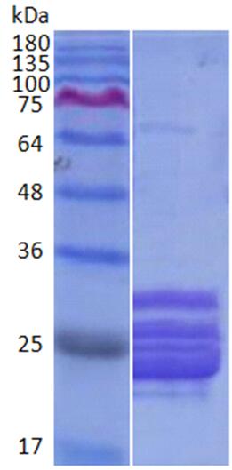 15% SDS-PAGE analysis of purified Mouse RHAMM (517–576), GST-tagged.